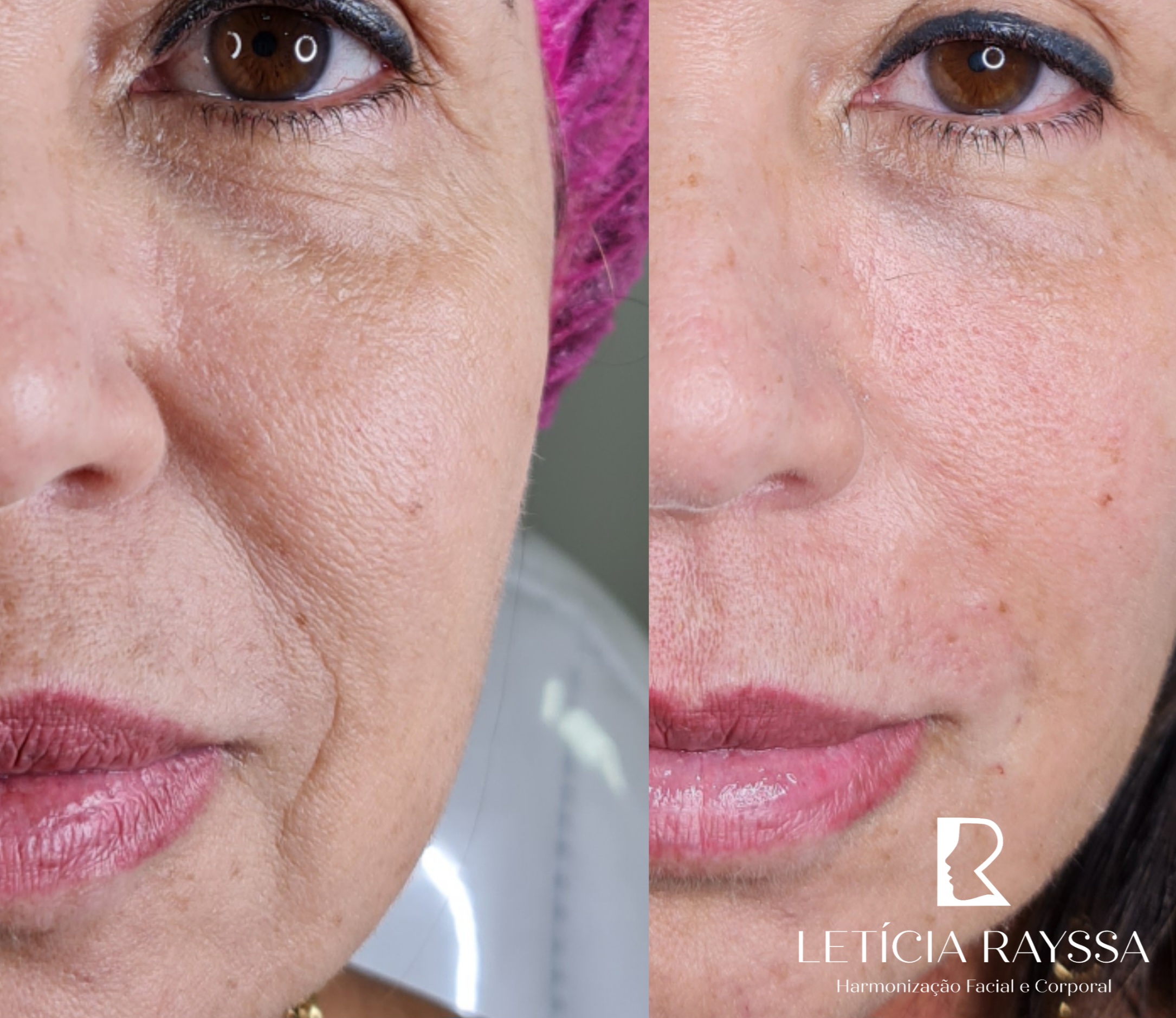 Processed with MOLDIV