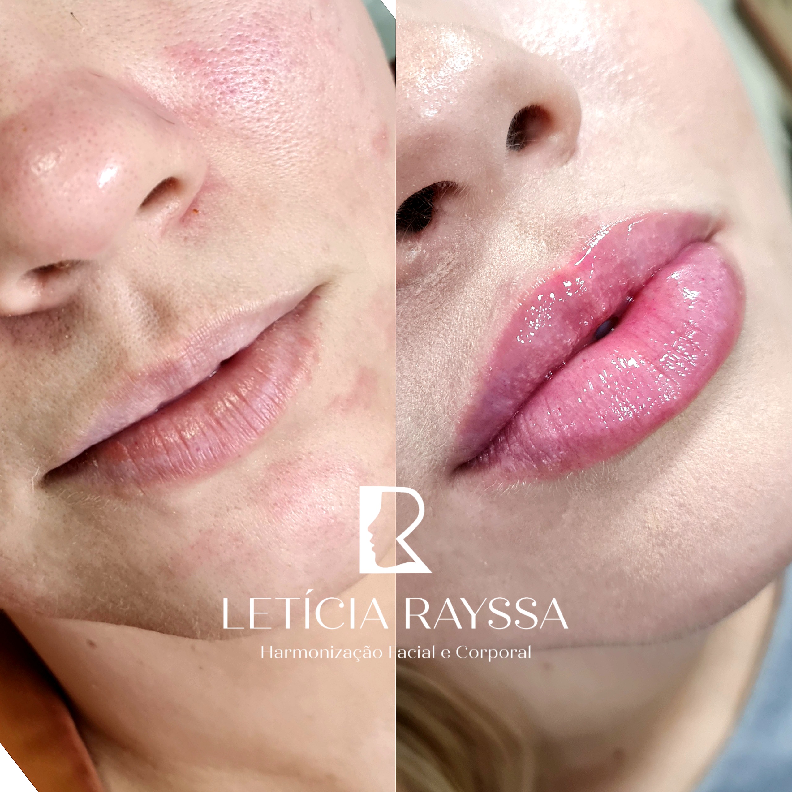 Processed with MOLDIV