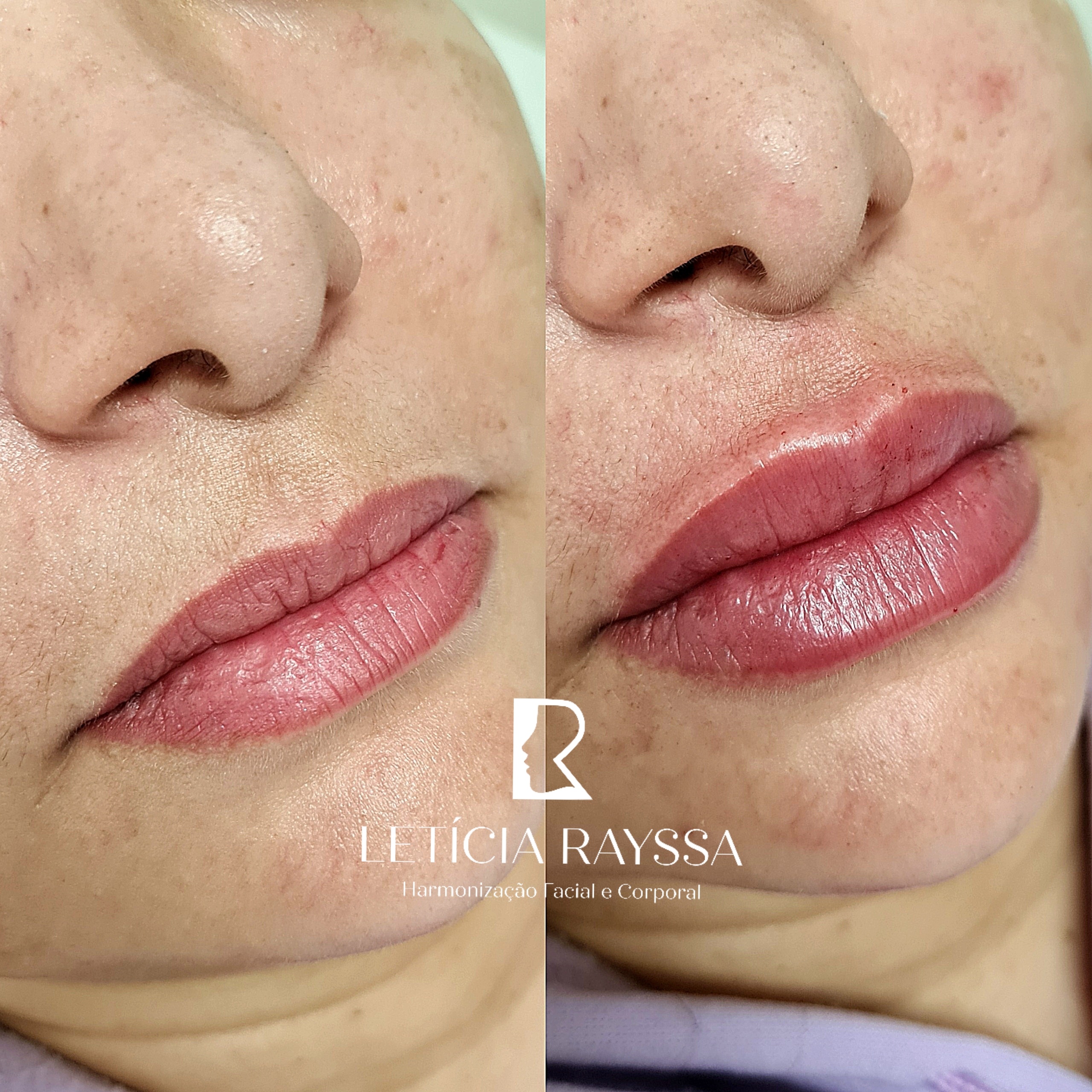 Processed with MOLDIV