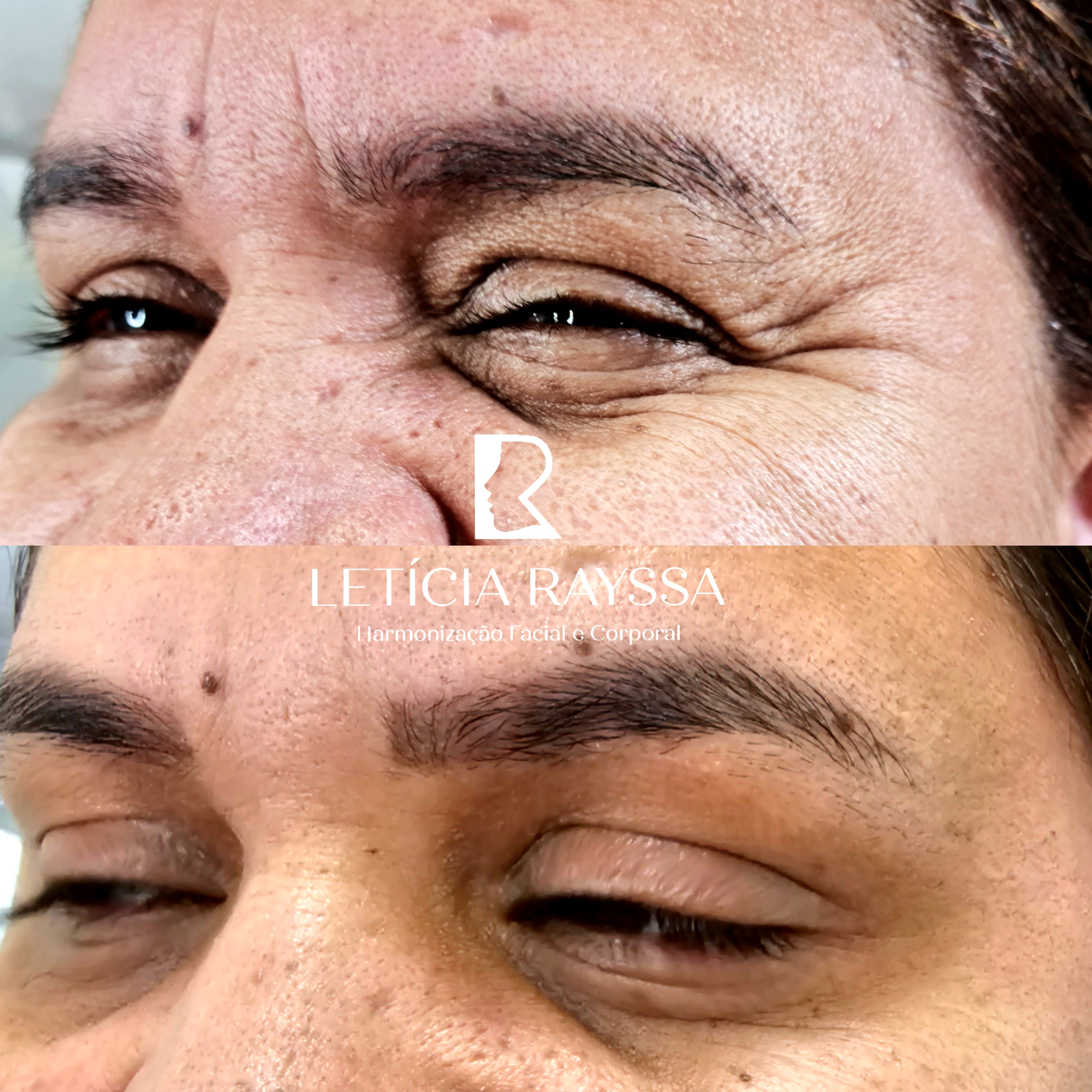 Processed with MOLDIV