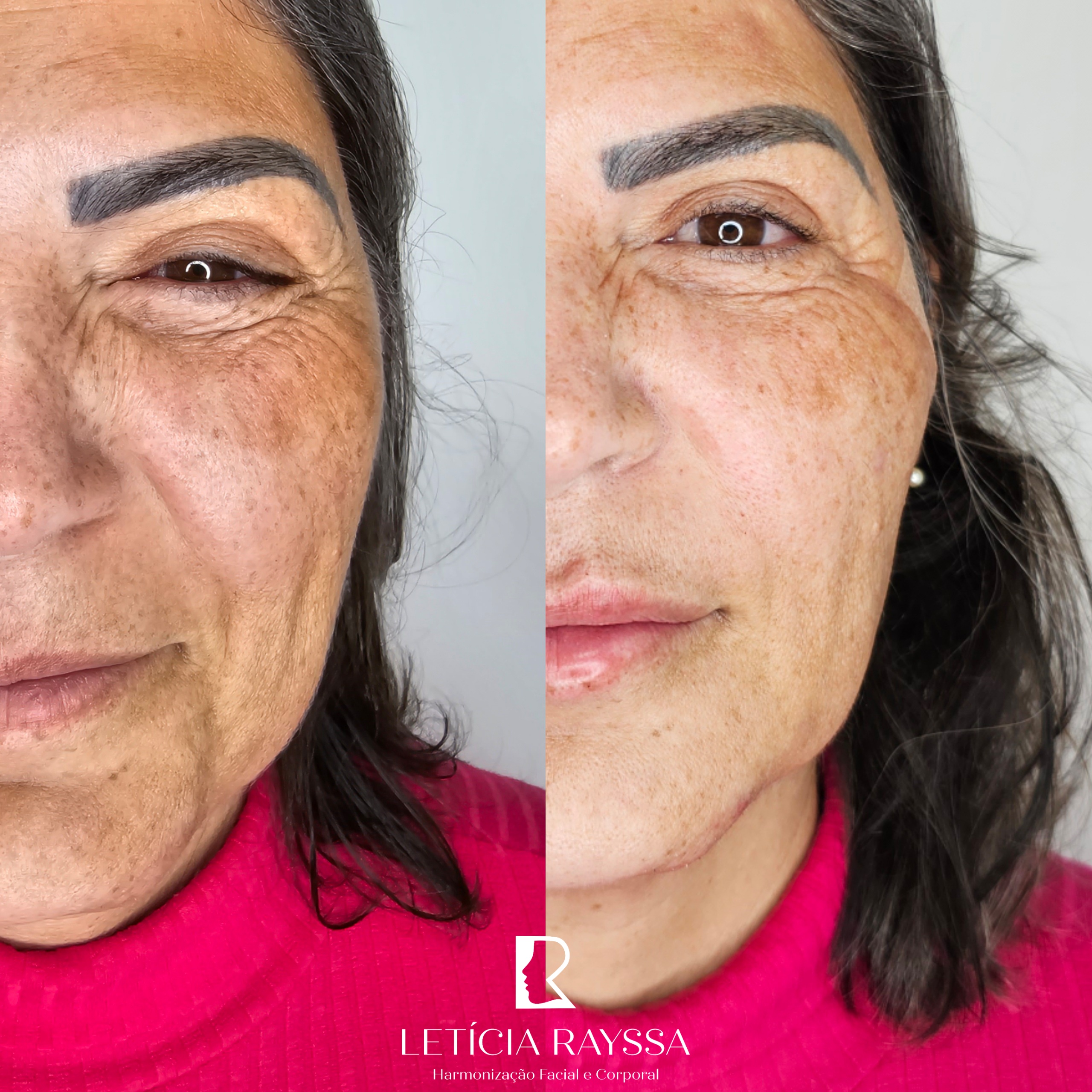 Processed with MOLDIV