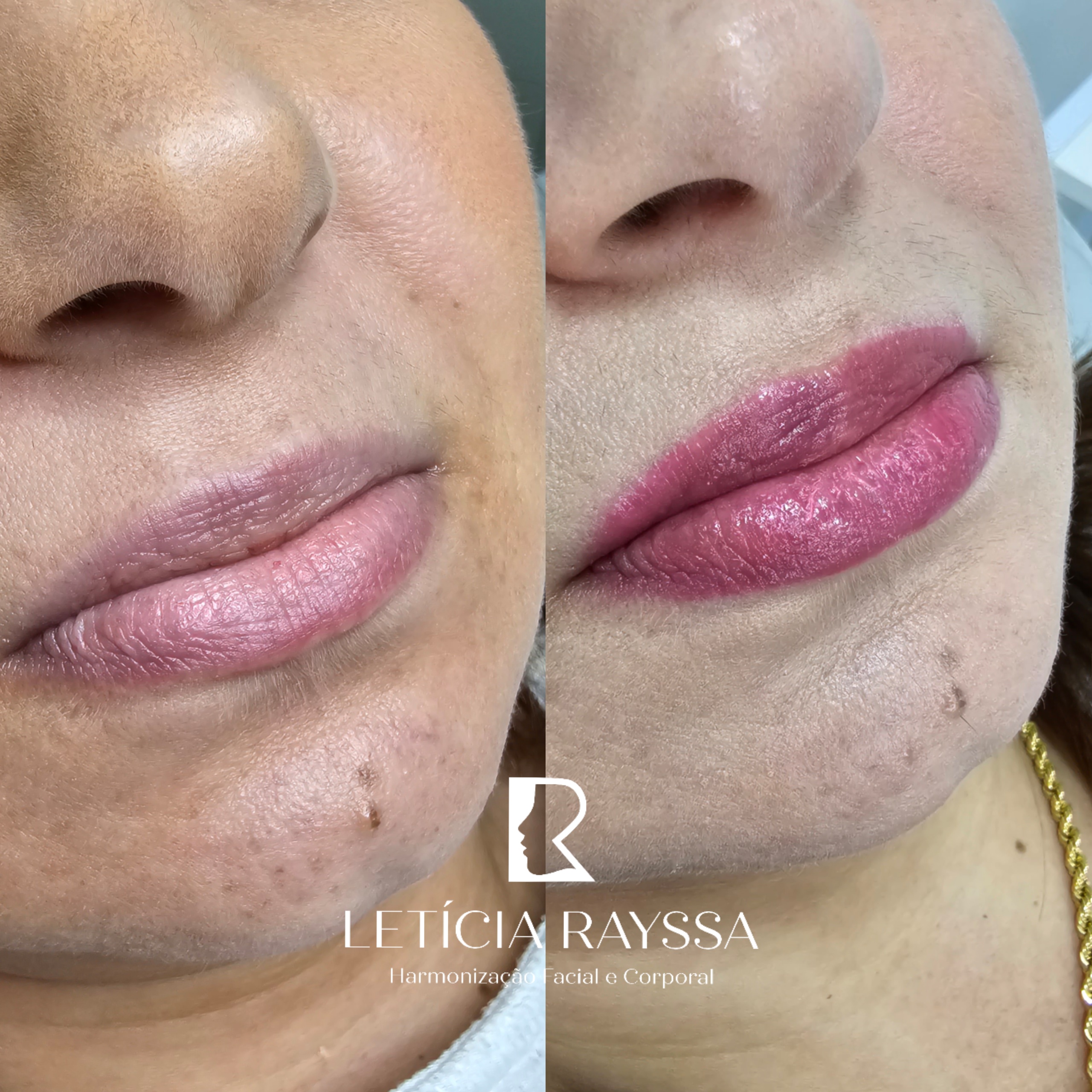 Processed with MOLDIV