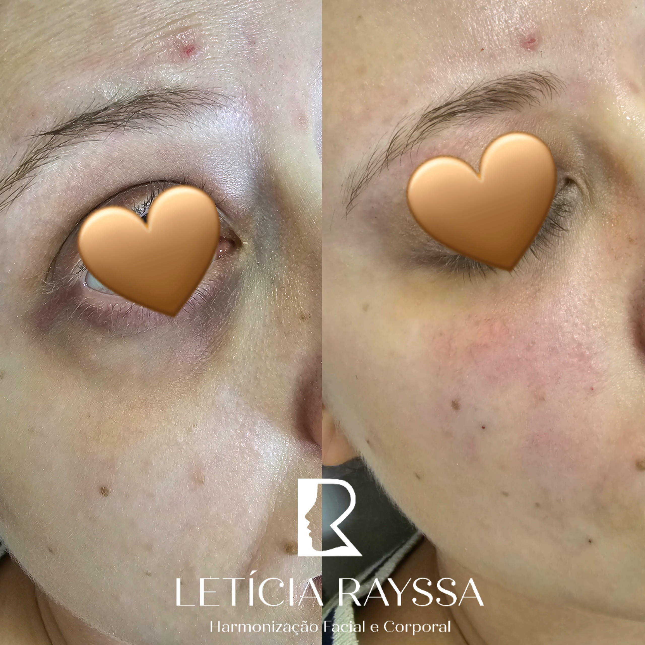 Processed with MOLDIV