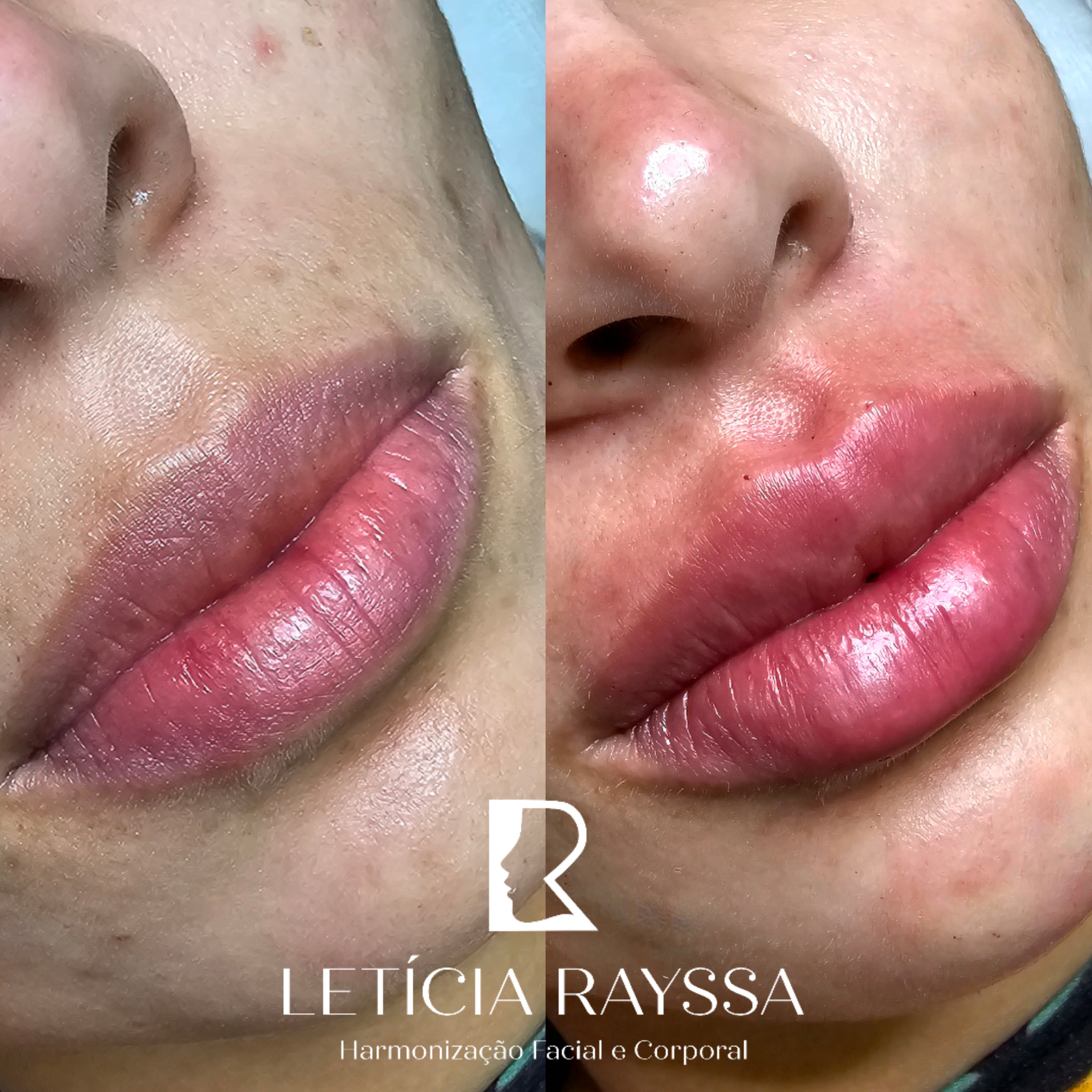 Processed with MOLDIV