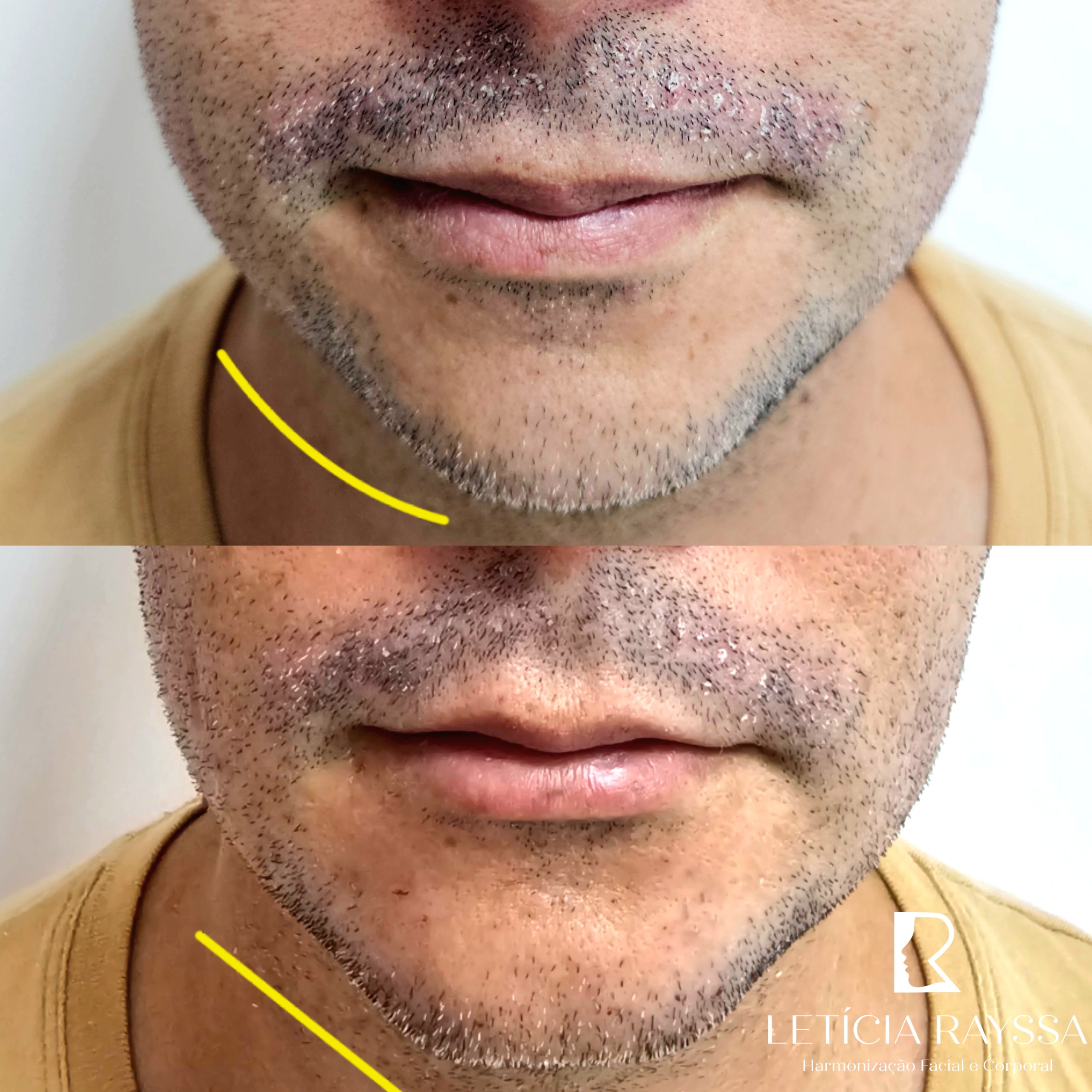 Processed with MOLDIV